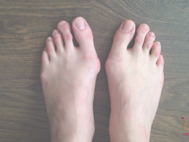 Award Winning Reflexology Spa and Salon in Adyar, Chennai - ilaa